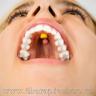 Myospot Anwendung